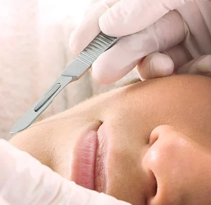 Kurz DERMAPLANING, OILPLANING